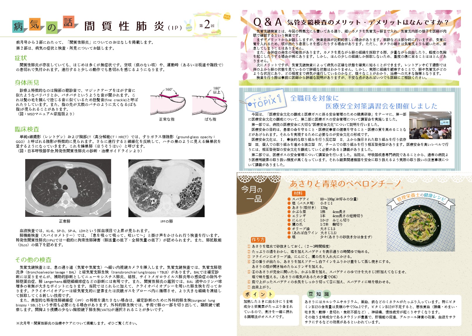 201904間質性肺炎2-2